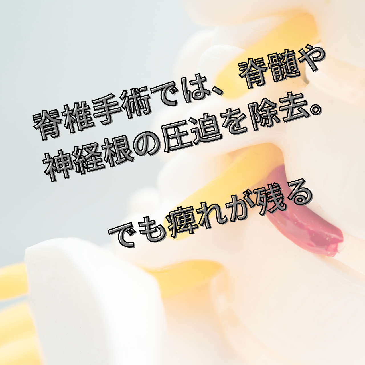 脊椎手術 登戸