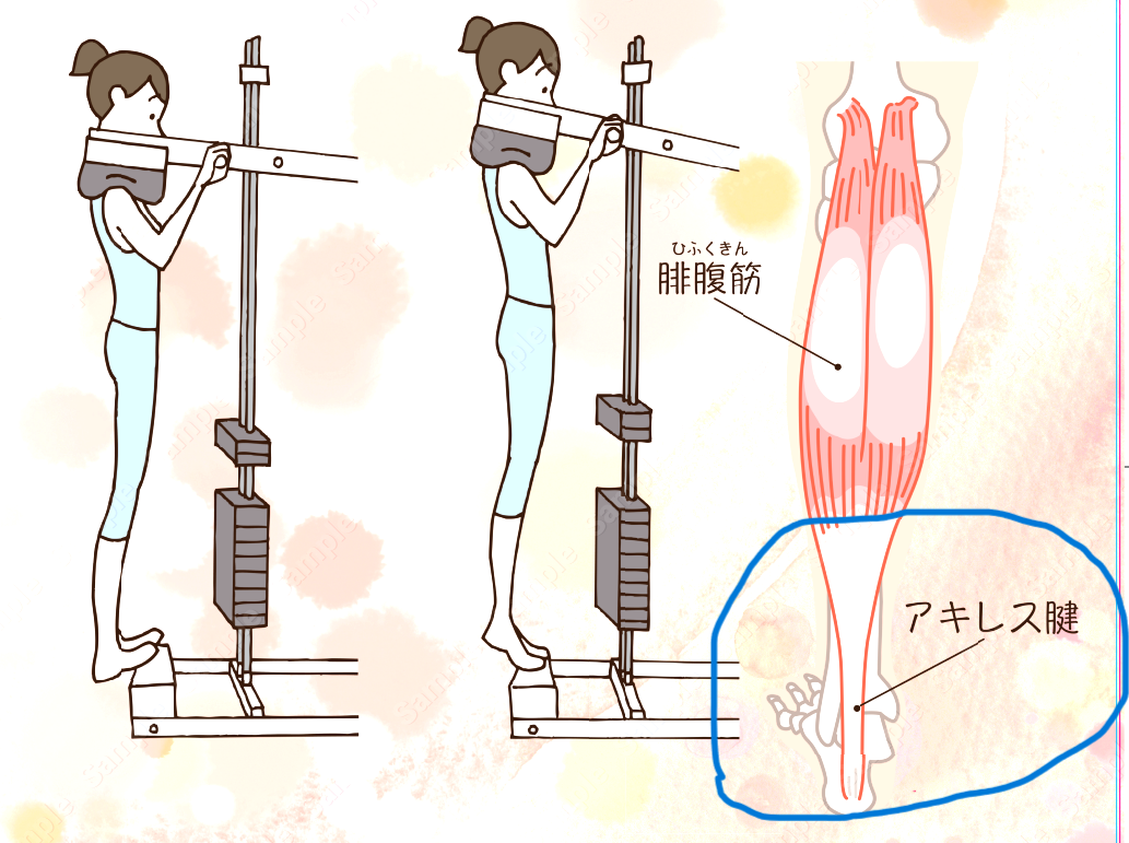 膝 ぐらつきカーフレイズ効果的