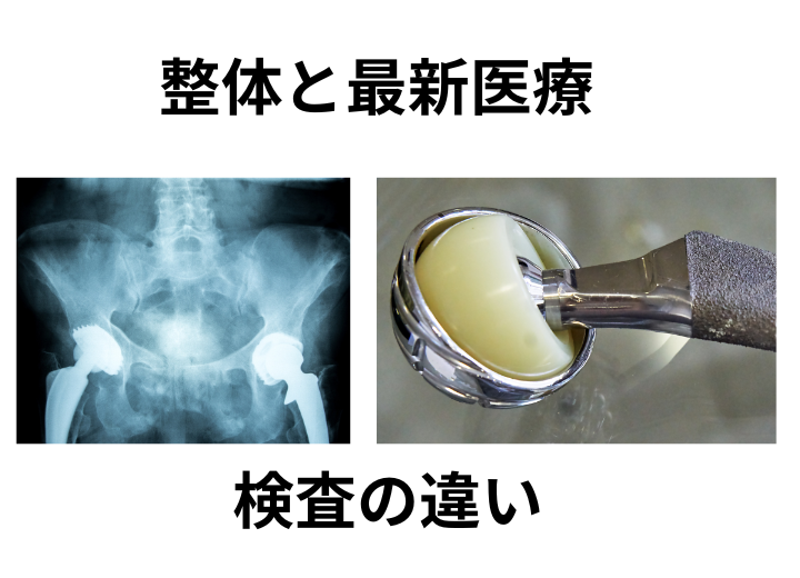 整体と整形外科など医療との重症な股関節・腰痛対応での違い