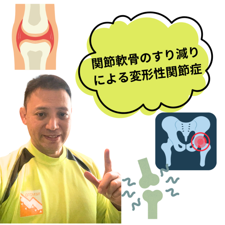 変形性膝関節症の筋トレにスクワットは正しいか？の画像