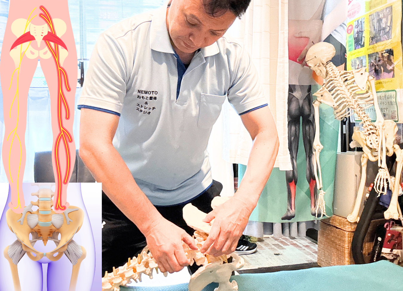 仙腸関節の機能不全が腰の神経を圧迫し、その神経が足につながるため痺れが起こります。