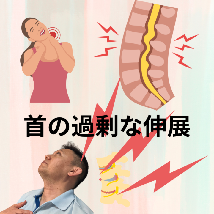首の過剰な伸展　首を後ろに反る理由