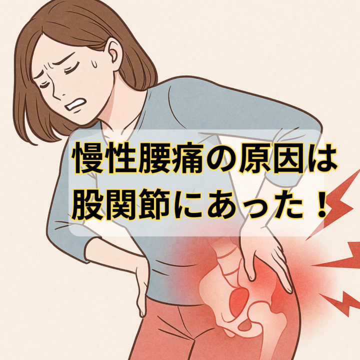 慢性腰痛の原因は股関節にあった！痛みの関係性と効果的な改善法の画像
