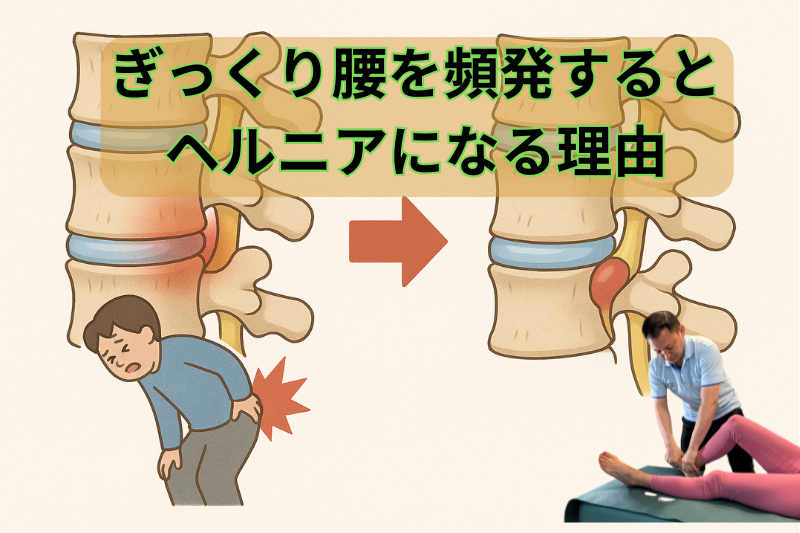 ぎっくり腰を頻発するとヘルニアになる理由