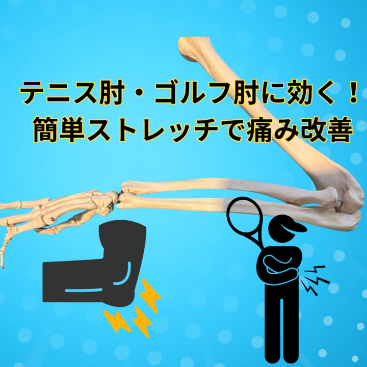 テニス肘・ゴルフ肘に効く！簡単ストレッチで痛み改善の画像
