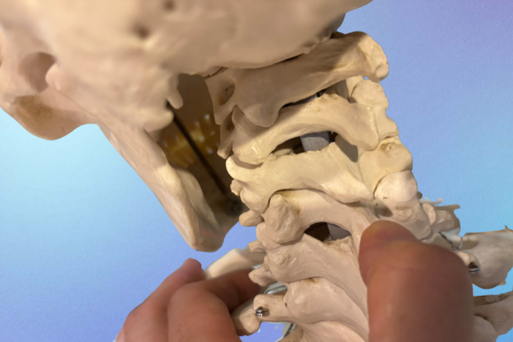 むち打ち症の原因となる頸椎部分を解剖模型で説明する様子