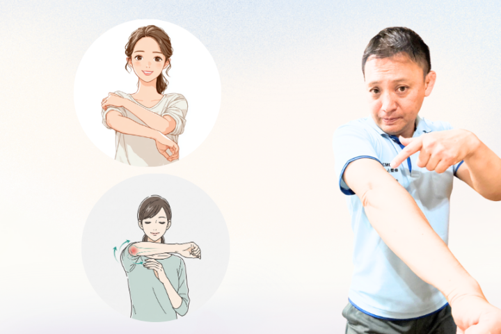 肘の痛み改善のためにストレッチを行う日本人女性のイラストと、それを指導する整体師の写真