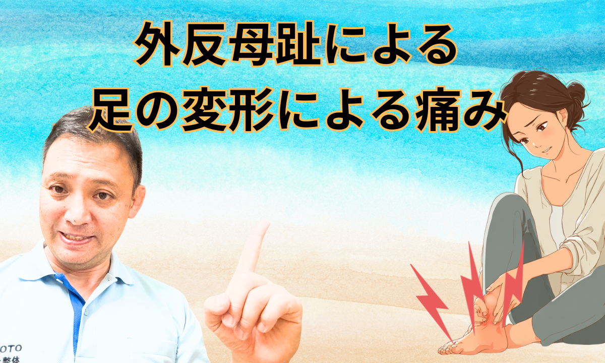 外反母趾による足の変形による痛み