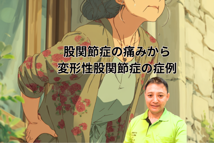 股関節症の痛みから変形性股関節症　50代主婦の画像