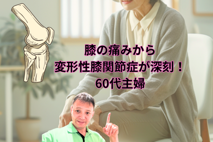 膝の痛みから変形性膝関節症が深刻！60代主婦の画像