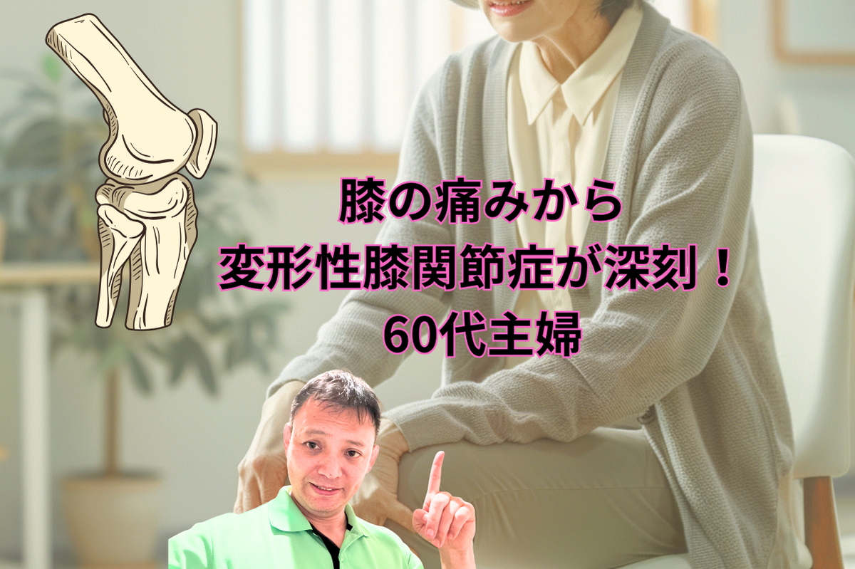膝の痛みから変形性膝関節症が深刻！60代主婦