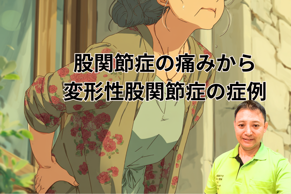股関節症の痛みから変形性股関節症