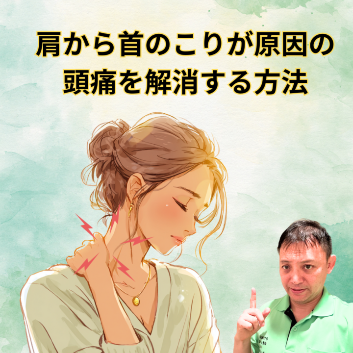 肩から首のこりが原因の頭痛を解消する方法の画像