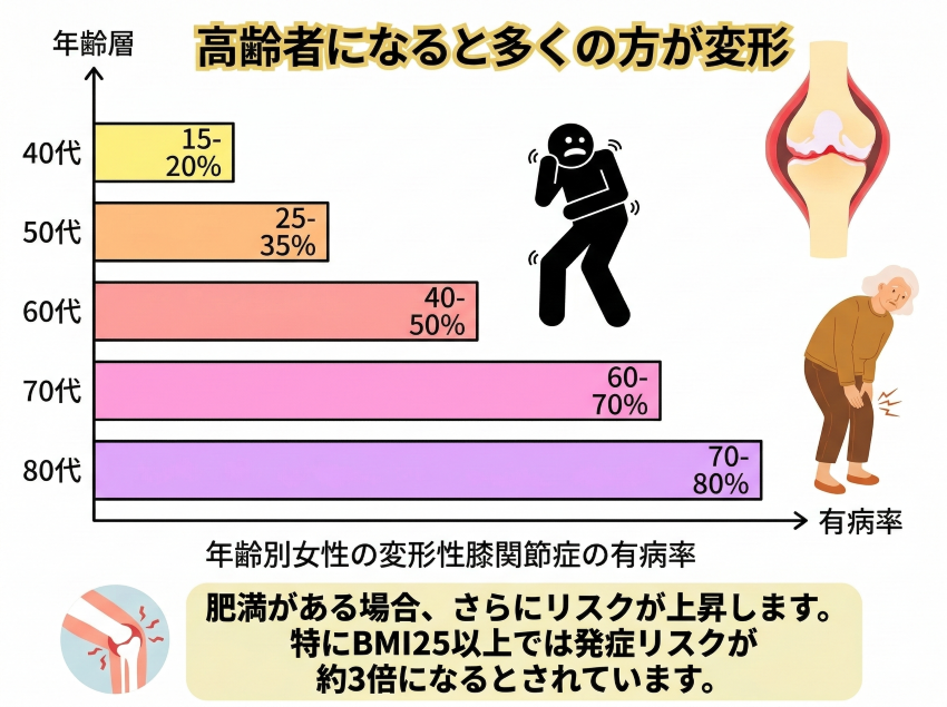 別女性の変形性膝関節症の有病率年齢層有病率40代15 ― 20%50代25 ― 35%60代40別女性の変形性膝関節症の有病率年齢層有病率40代15 ― 20%50代25 ― 35%60代40